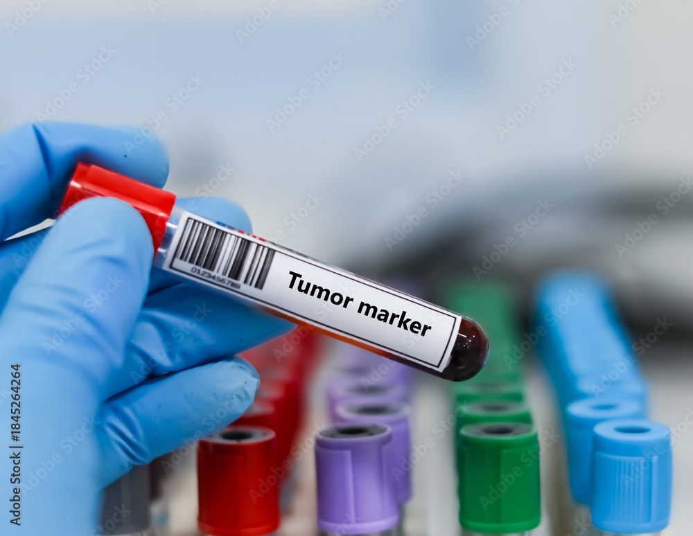 Oncology Biomarkers
